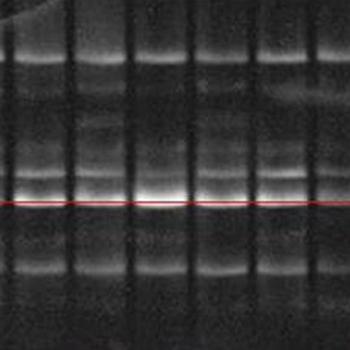 明膠酶譜MMP(2/9)檢測(cè)實(shí)驗(yàn)